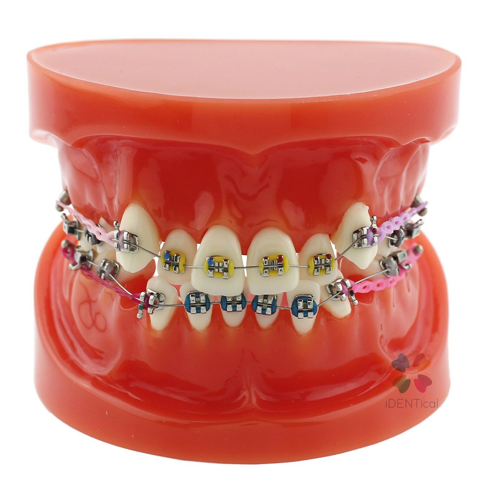 iDENTical Dental Orthodontic Models M3005