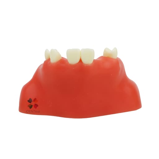 iDENTical Dental Sinus Lift Practicing Model M2014