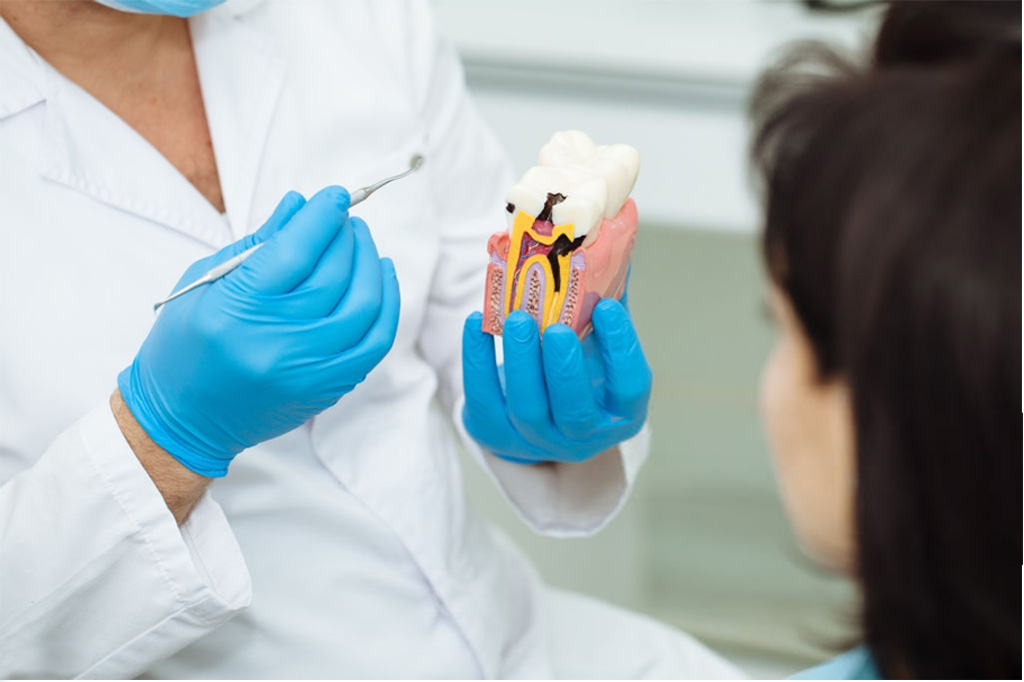 iDENTical Caries V/S Healthy Teeth Model M4021