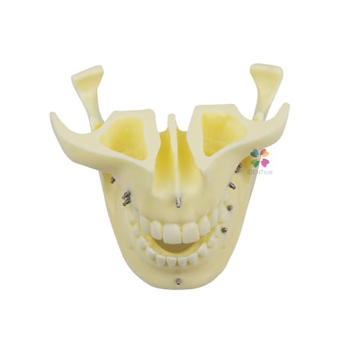 iDENTical Orthodontic Implant Model - M2016