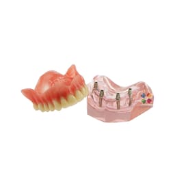 iDENTical Dental Model for Overdenture Maxilla M6001 - 3