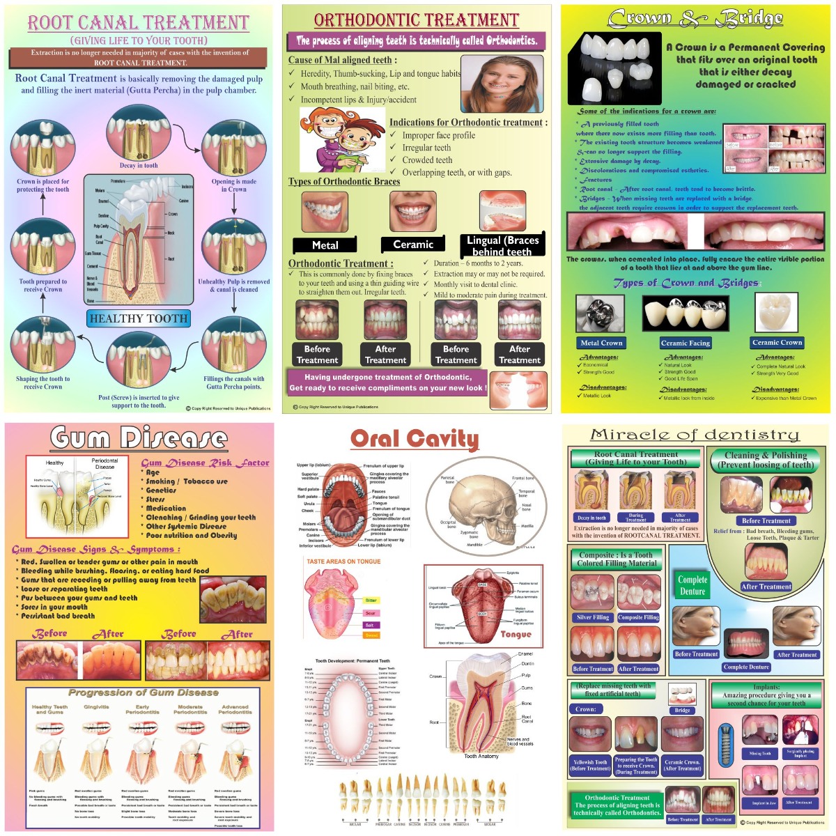 Unique Dents Dental Education Posters (DWP01) - Set Of 6