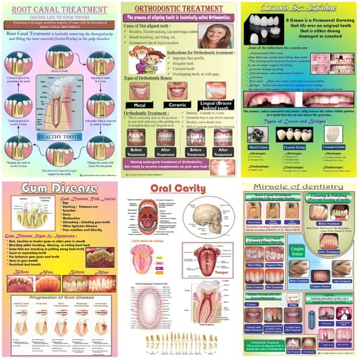 Unique Dents Dental Education Posters (DWP01) - Set Of 6 