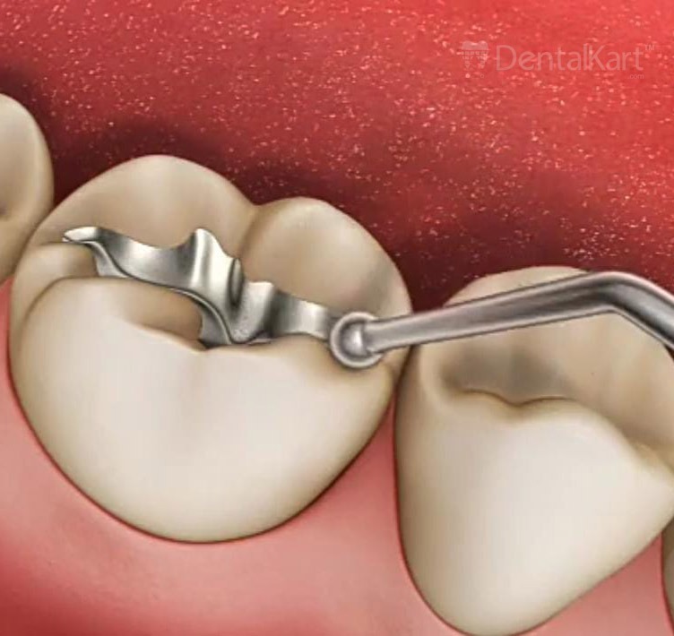 Waldent Plastic Filling Instrument Ball Burnisher + Condenser 15/732