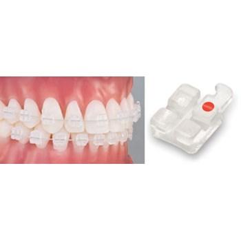 UU Ortho Mono Crystalline Sapphire Transparent Ceramic Brackets