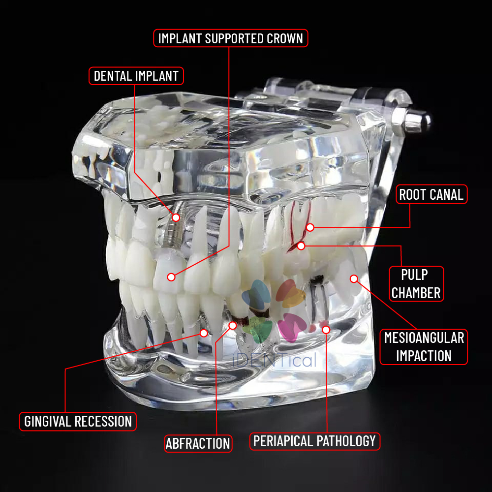 iDENTical All In One Implant Models M2001