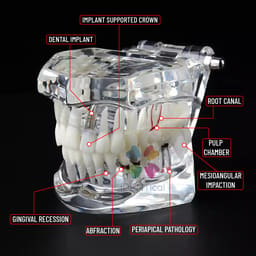 iDENTical All In One Implant Models M2001 - 11