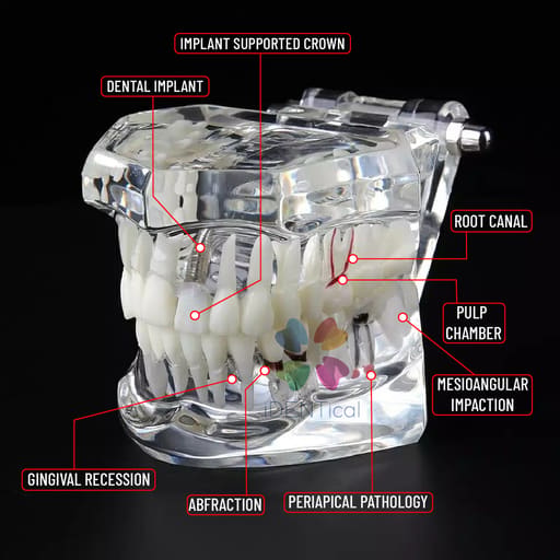 iDENTical All In One Implant Models M2001