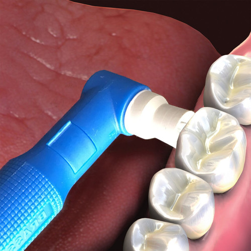 Cotisen Prophy Polishing Cups - Latch Type (White Color) (Pack of 100)