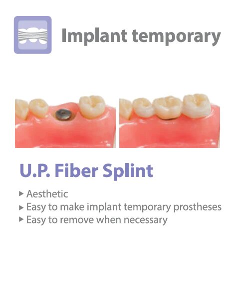 Inod U.P Fiber Splint