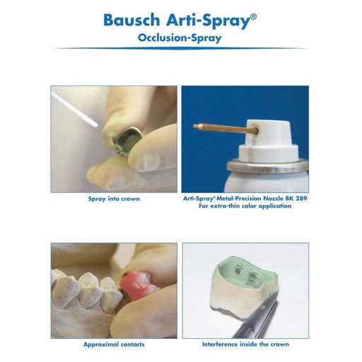 Bausch Precision Nozzle for Arti-Spray - BK 289