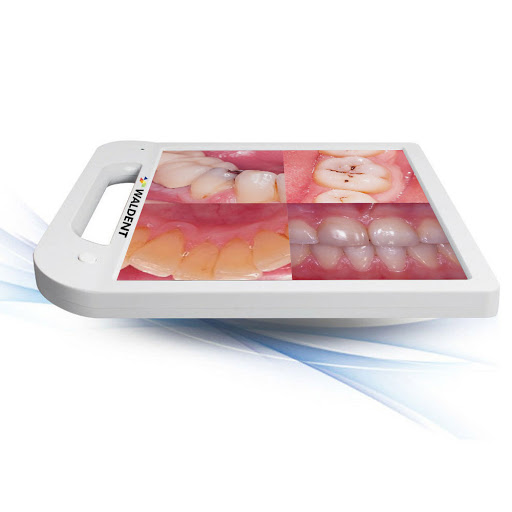 Waldent Intra Oral Camera with Screen - Ergo (10 MP)