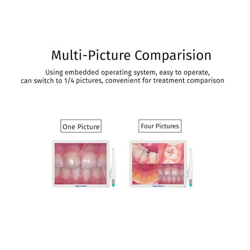 Waldent Intraoral Camera Smart -Cam with PMS