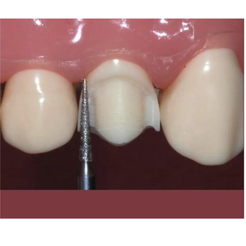 Frank Dental Tapered Cone FG Diamond Burs TC Series ( Super Coarse)