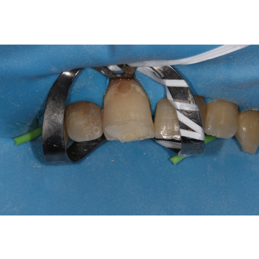 GDC Rubber Dam Clamp Adult 211 (Rdc211)