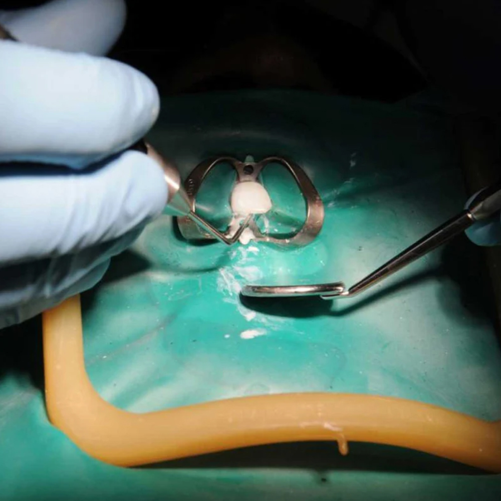 GDC Rubber Dam Clamp Adult 210 (Rdc210)