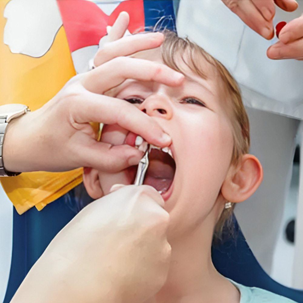 Oracraft Extraction Forceps Pedo Set Of 7 In Pouch Standard - EFSP7