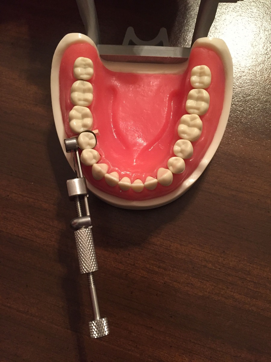 Tor Vm Metal Striprolls