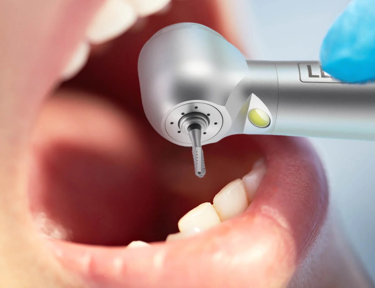 Prima Dental Flat Fissure Bur (Cross Cut)