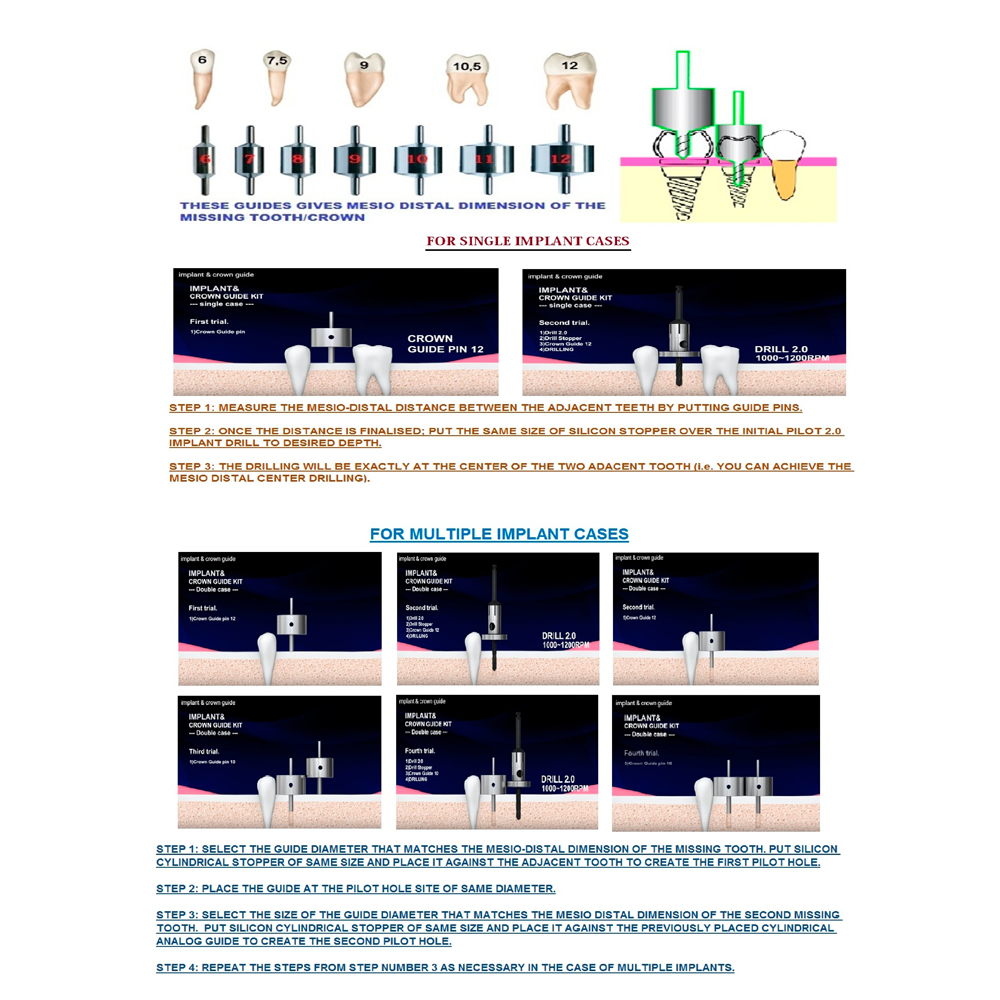 Julldent Mesio Distal Guidance System Kit (Jull-Dent 027)