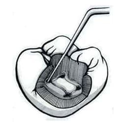 Waldent Endodontic Explorer DG 16 (15/725) - 8