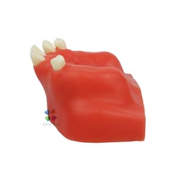 iDENTical Dental Sinus Lift Practicing Model M2014 - 3