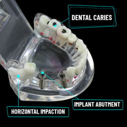 iDENTical All In One Dental Implant Model - M2001 (White) - 8