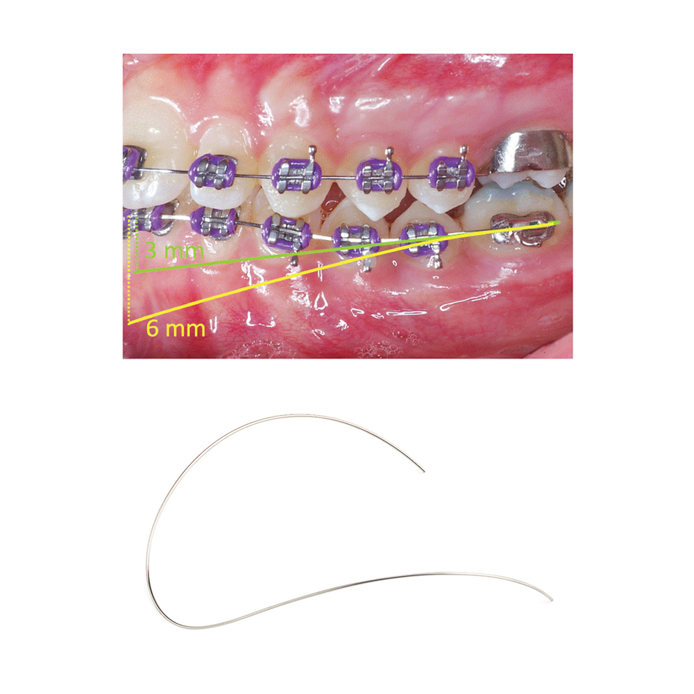 U ortho Niti Reverse Curve Arch Wire-Ovoid
