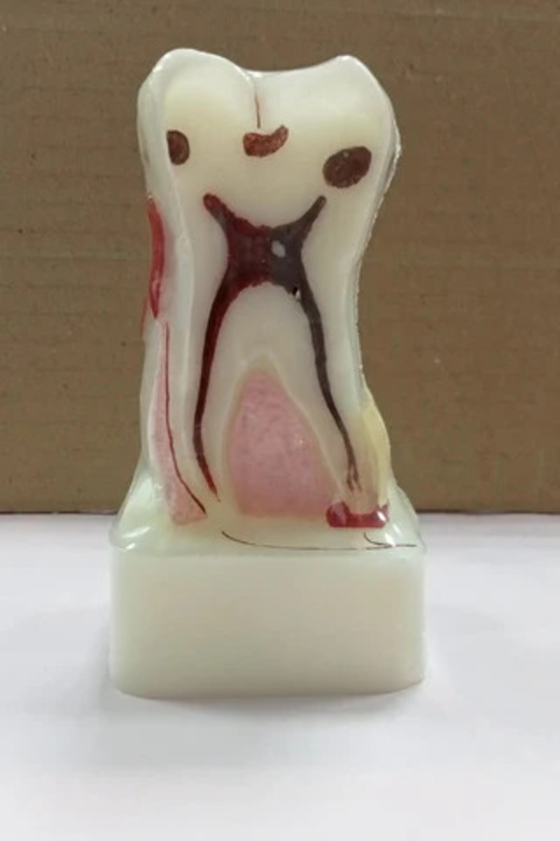 iDentical 4X Pathologies Of Tooth Model - M4015