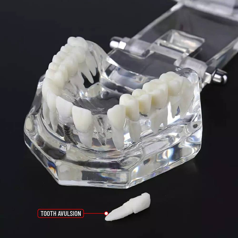 iDENTical All In One Implant Models M2001