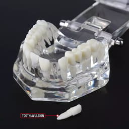 iDENTical All In One Implant Models M2001 - 10