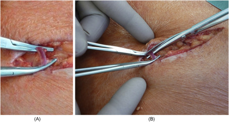 Oracraft Crile Hemostat