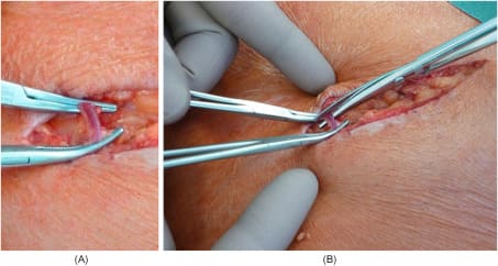 Oracraft Crile Hemostat