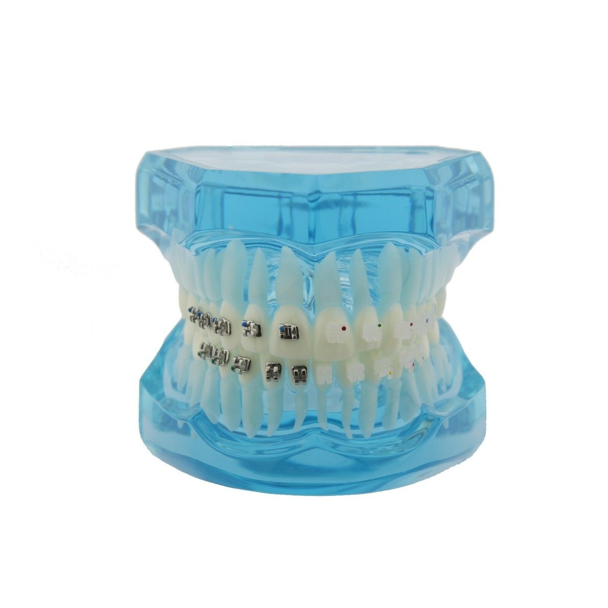 iDENTical Half Metal And Half Ceramic Brackets Orthodontics Model - M3003 (Blue)