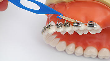 Wonder Tooth Colour Elastics