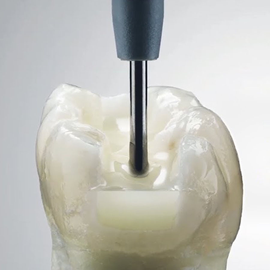 Dentsply SDR Plus Flowable Bulk Filling Material 
