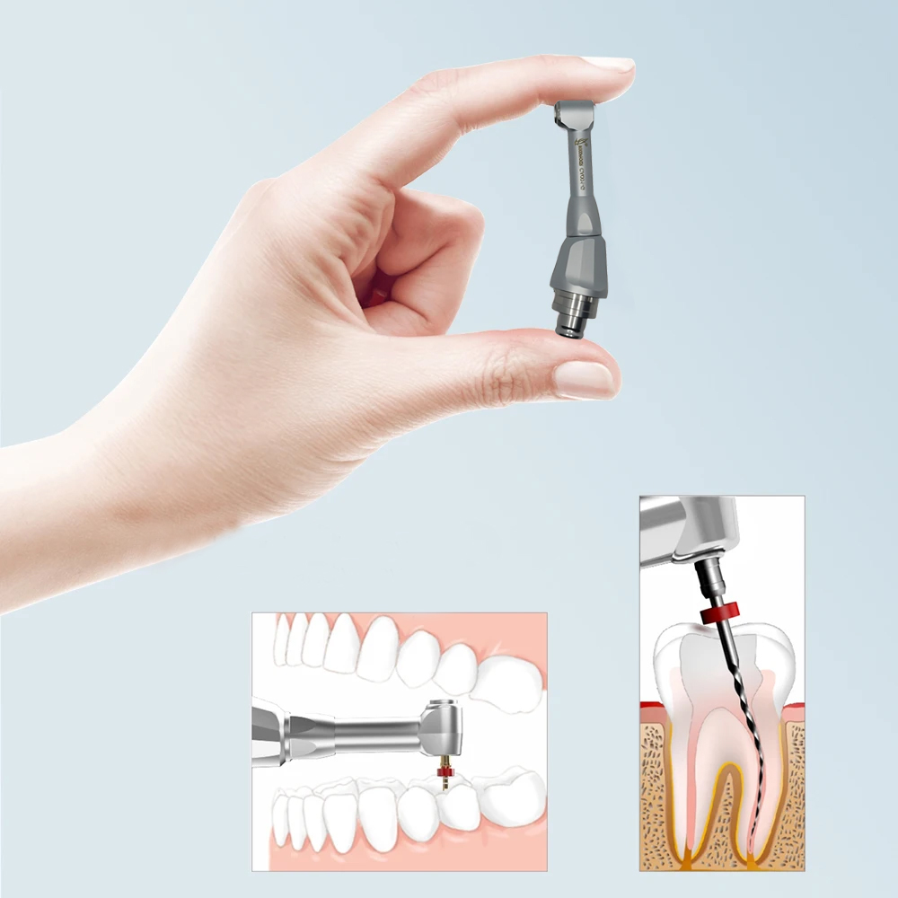 Woodpecker Endomotor Contra Angle Handpiece Heads