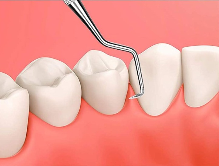 Waldent Explorer 23/17 ( 13/105 )   