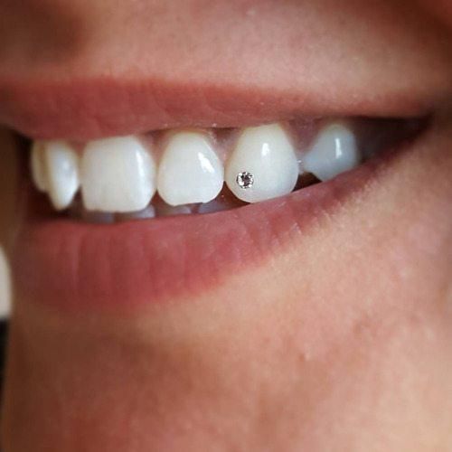 Tooth Jewellery (Set of 5)- White Crystals