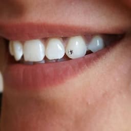 Tooth 