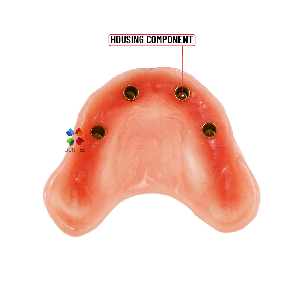 iDENTical Dental Model for Overdenture Maxilla M6001