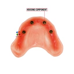 iDENTical Dental Model for Overdenture Maxilla M6001 - 7