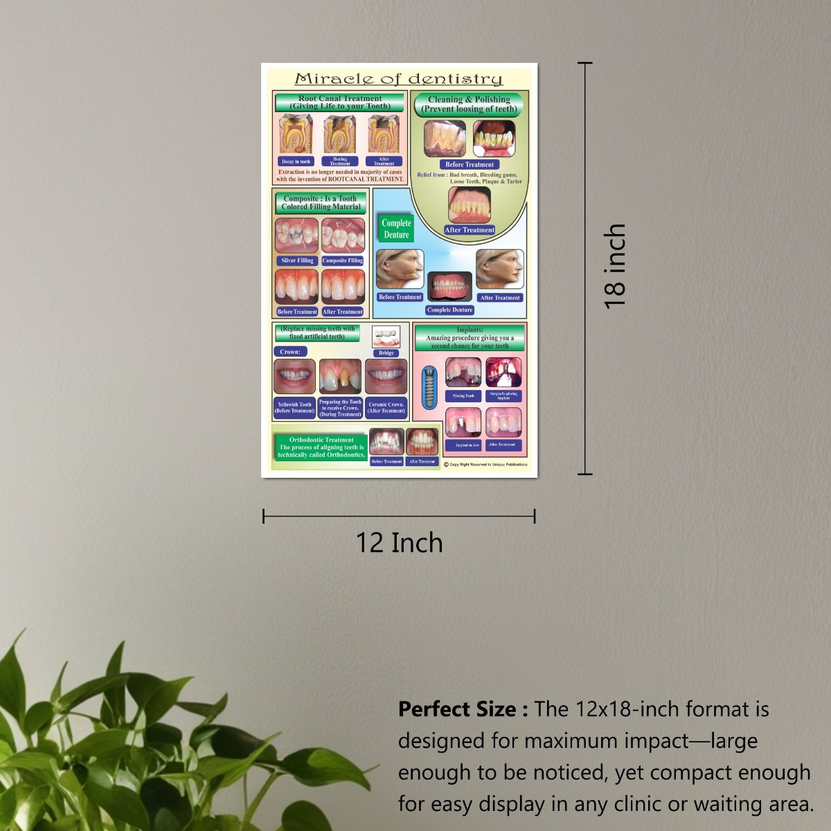 Unique Dents Dental Education Posters (DWP01) - Set Of 6 