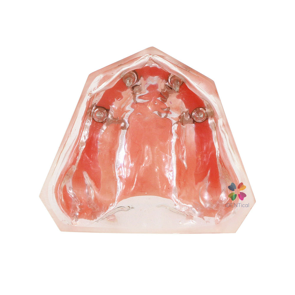 iDENTical Dental Model for Overdenture Maxilla M6001