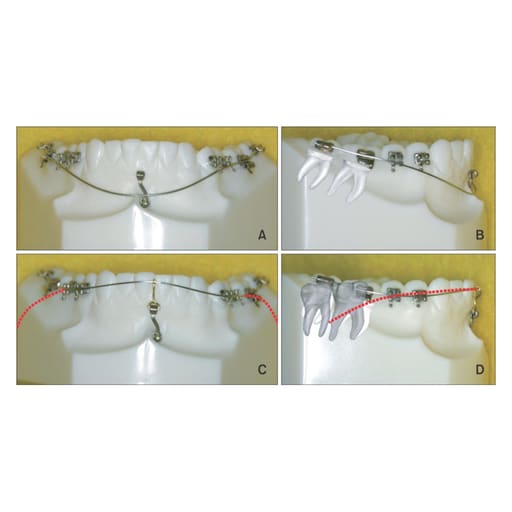 U ortho Niti Reverse Curve Arch Wire-Ovoid (Pack of 2)