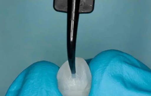 Ultradent Porcelain Silane # 410-1