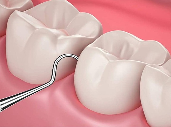 Waldent Explorer 23/17 ( 13/105 )   