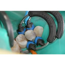 Garrison Dental Composi-Tight 3DXR Ring (3DXR-1) - 3