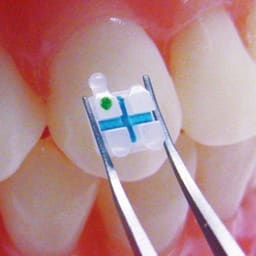 3m Unitek Clarity Advanced Ceramic Brackets - 8
