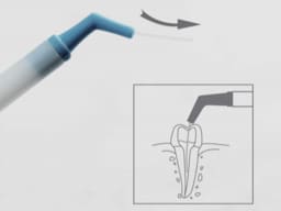 Cotisen Endodontic Aspirator Tip ( Pack of 1 ) - 12